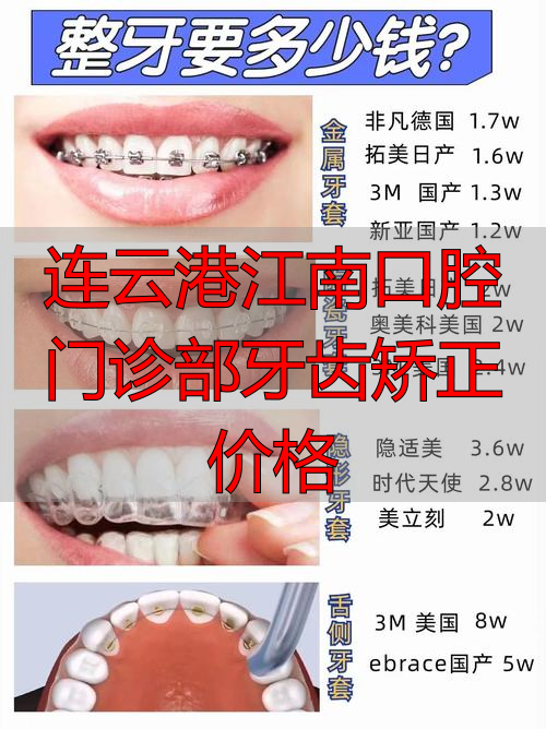 连云港江南口腔门诊部牙齿矫正价格_连云港隐形矫正价格_连云港正畸医院排名