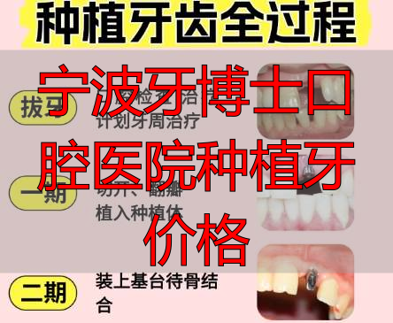 种植牙