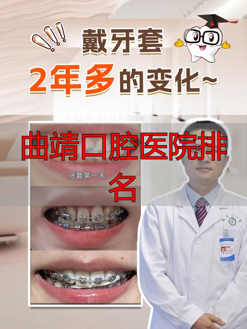 曲靖市灵活牙套技术医院推荐_曲靖市专业牙套矫正医院排名_曲靖口腔医院排名