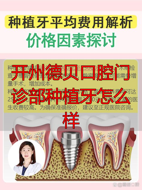 口腔诊所种植牙_口腔门诊开展种植需要什么手续_开州德贝口腔门诊部种植牙怎么样