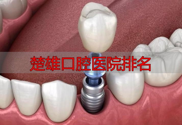 楚雄公立的口腔医院_楚雄口腔医院排名_楚雄市医院口腔科价目表
