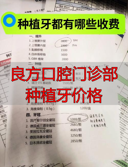 口腔牙科种植牙_口腔科种植牙齿多少钱_良方口腔门诊部种植牙价格