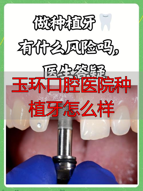 口腔医院种植牙齿_玉环口腔医院种植牙怎么样_口腔牙样种植玉环医院能做吗