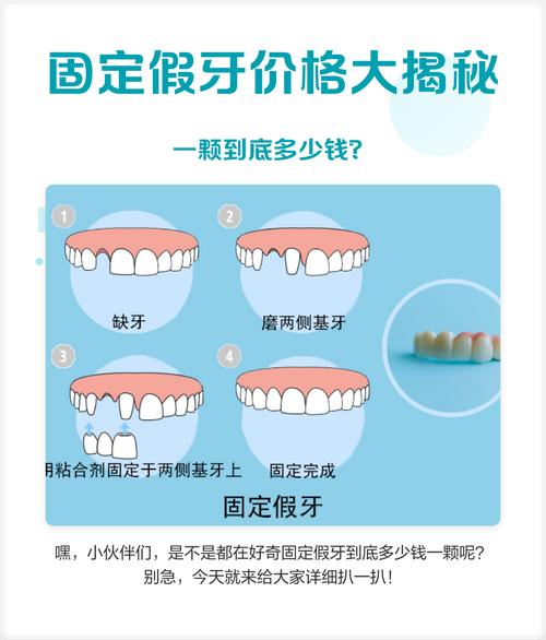 宁波雅禾口腔诊所假牙价格_宁波牙科_宁波假牙加工厂