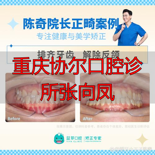 重庆口腔医院张丰婧_重庆口腔医院张一_重庆协尔口腔诊所张向凤