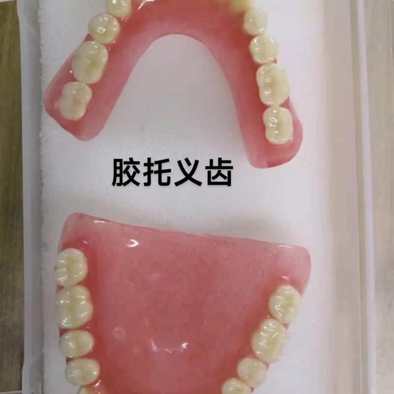 洁诚口腔诊所假牙价格_口腔医院洁牙方式_口腔洁牙科