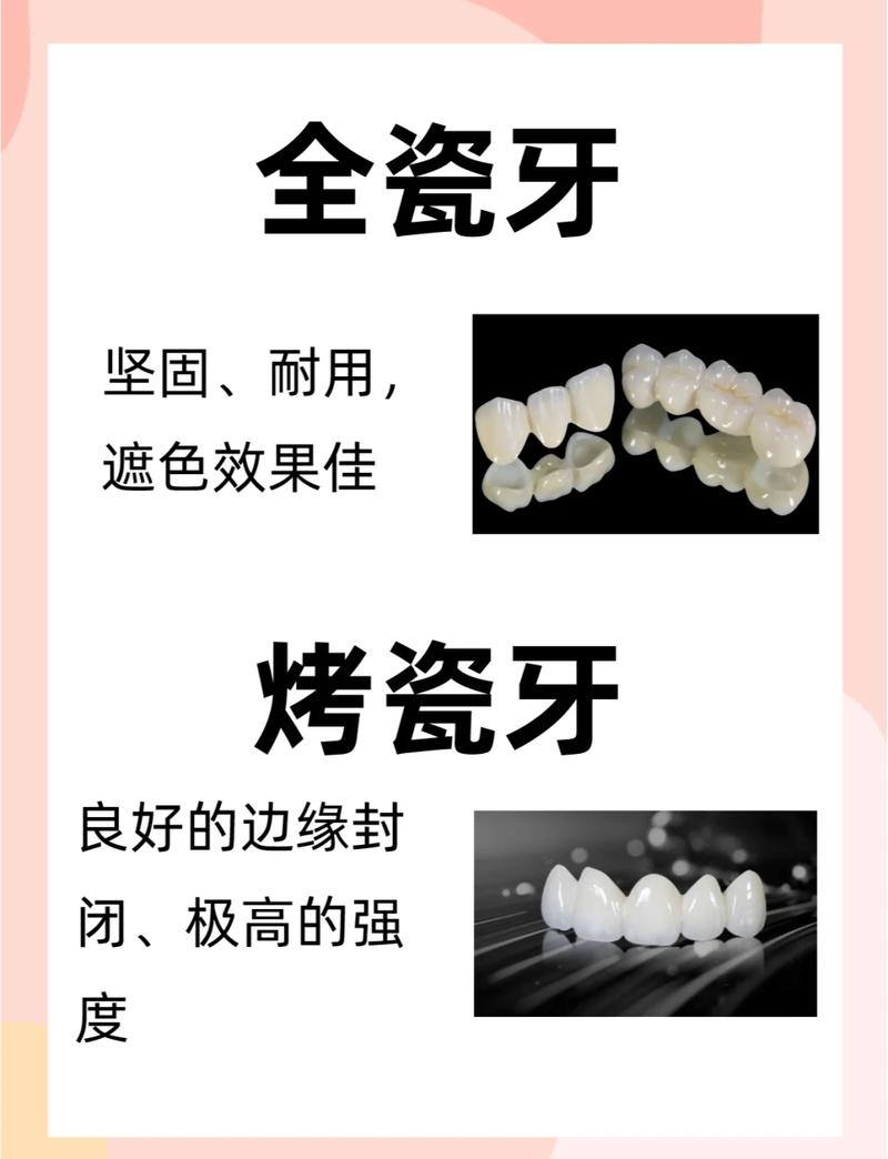 口腔医院假牙价格_洞口牙齿矫正医院好_共昌洞庭路口腔门诊部假牙价格