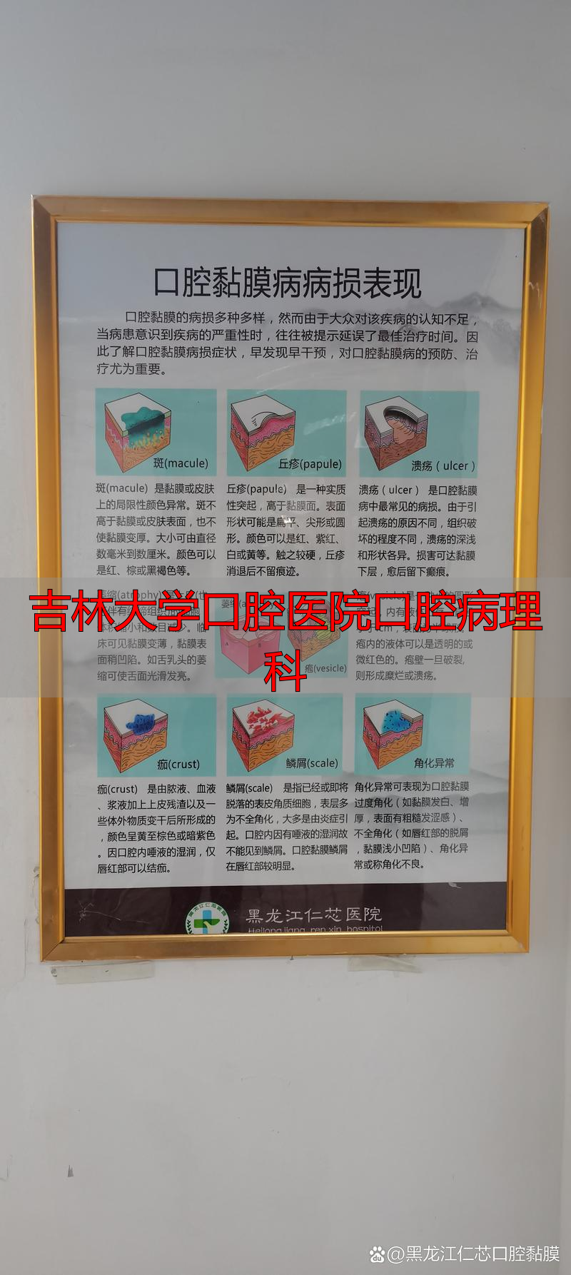 2025年口腔医院病理科盘点：深入评价吉林大学王牌诊断实力怎么样