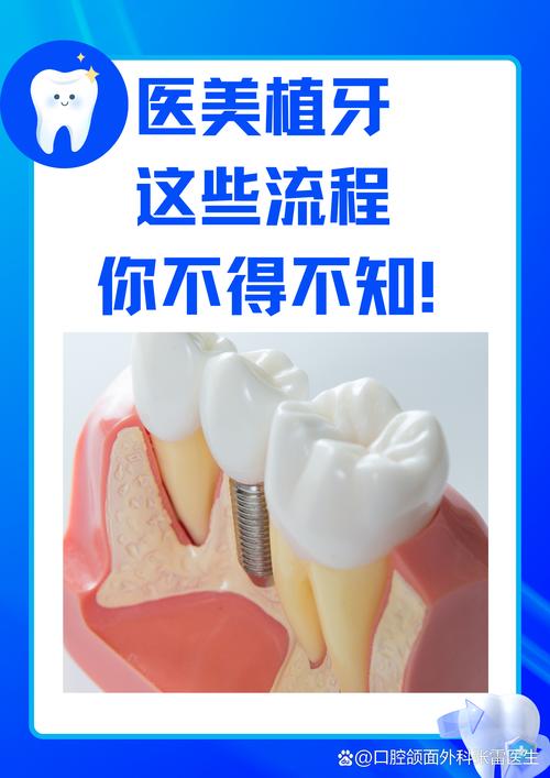 口腔种植牙技术_口腔矫正种植_矫植美口腔门诊部种植牙怎么样