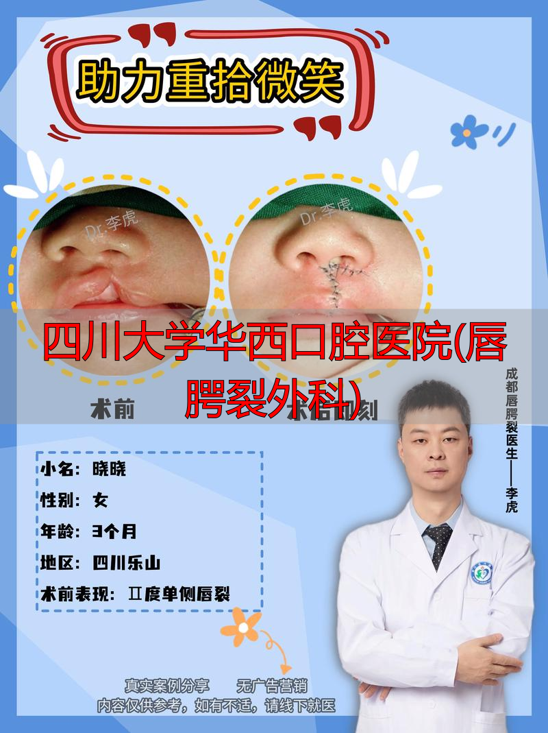 2026年华西口腔医院唇腭裂外科真实评价深度解析：顶尖品牌到底怎么样？
