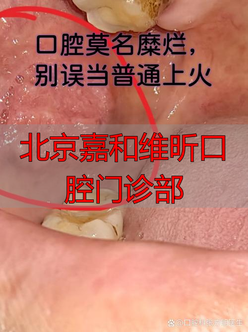 北京嘉和维昕口腔门诊部_北京维嘉口腔诊所_北京嘉和口腔西城店