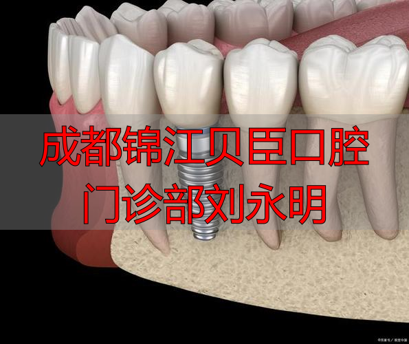 成都锦江贝臣口腔门诊部刘永明_康强网武汉社区门诊口腔室承包_刘锦雄口腔诊所