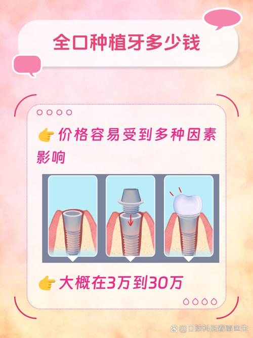 南宁诺贝尔口腔种植牙技术怎么样？埌东店总院价格、医生资质、就诊体验全解析