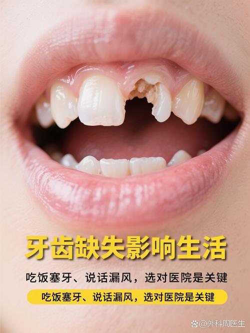 常州口腔种植牙医院即拔即种利弊_常州口腔医院排名_茀莱堡口腔医院即拔即种种植牙优势与风险