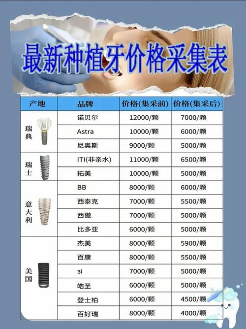 国家医保局口腔种植专项治理_华海口腔医院种植牙价格_口腔种植体集采价格