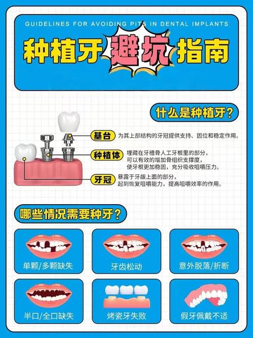 温州永嘉肖尔口腔种植牙价格_口腔种植体系统集中带量采购_种植牙价格下降55%