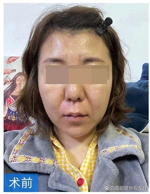 上海摩尔星辰口腔医院熊悬峰_上海摩尔星辰口腔医院熊悬峰_上海摩尔星辰口腔医院熊悬峰