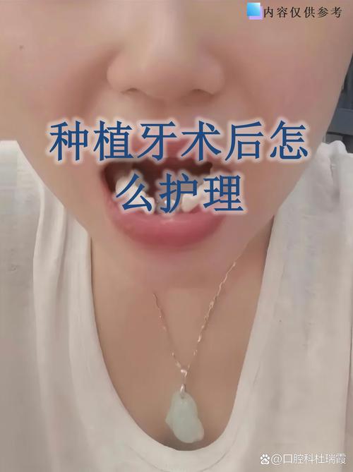 东莞南城众芽口腔种植牙_东莞南城优梨口腔门诊部_吴君让医生种植技术