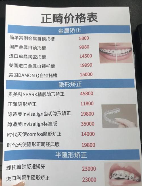 海口爱牙口腔种植牙费用_海口爱牙口腔医院价格表_海南国雅口腔医院张乐音