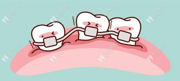 爱牙口腔矫正牙齿多少钱