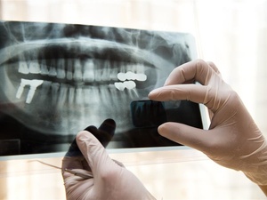 武汉种植牙医院排名前十“榜单揭晓”种植牙多少钱一颗2025价格表