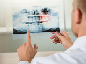 重磅公布!武汉看种植牙专科医院名单盘点:种植牙收费大概多少