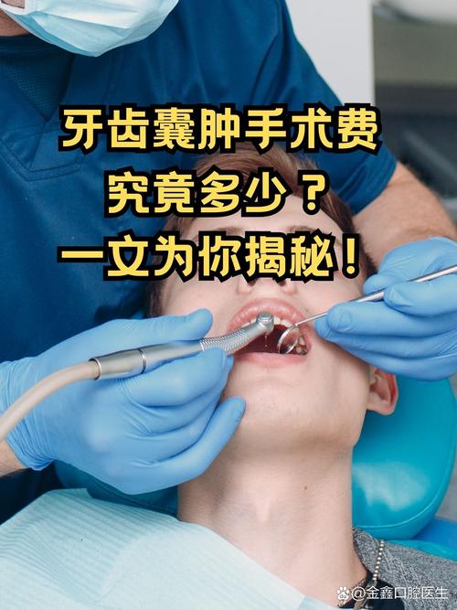 烟台市口腔医院开窗引流术_口腔医院怎么样_根尖囊肿治疗案例