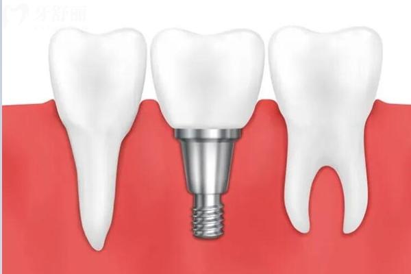 宜春康贝口腔医院上班时间表查询,地址、营业时间、实力与收费价格表全知道